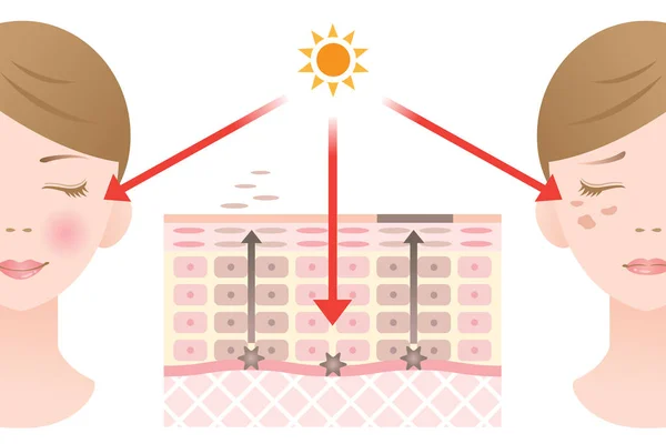 Manos limpias. higiene de manos. concepto de atención sanitaria . — Archivo Imágenes Vectoriales