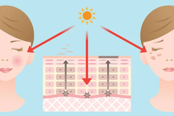 普通的皮肤细胞更替和减缓皮肤细胞更替图 — 图库矢量图片