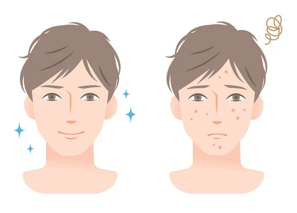 Joven con acné en la cara antes y después del tratamiento facial — Vector de stock