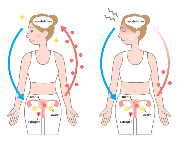 Mecanismo Menopausia Mujer Joven Niveles Estrógeno Caen Menopausia — Vector de stock