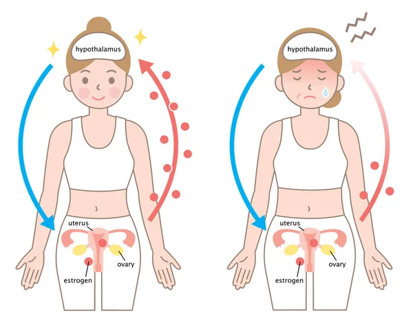 Mecanismo Menopausia Mujer Joven Niveles Estrógeno Caen Menopausia — Vector de stock