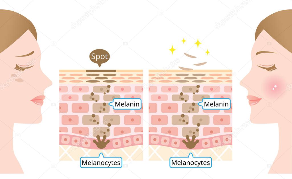 infographic skin cell turnover illustration. Melanin and melanocytes in human skin layer with woman face. beauty and skin care concept