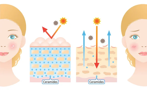 Piel Joven Contiene Ceramidas Que Producen Aspecto Húmedo Piel Envejecida — Archivo Imágenes Vectoriales