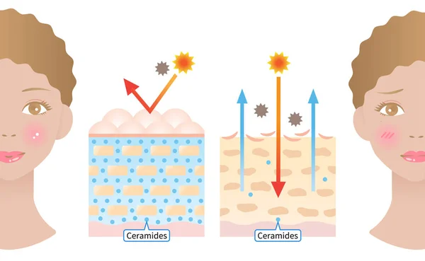 Piel Joven Contiene Ceramidas Que Producen Aspecto Húmedo Piel Envejecida — Vector de stock