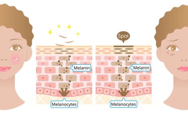 Deri hücre değişimi ve siyah kadın yüzü. Melanin ve melanositler, kadın yüzlü insan derisi katmanında. güzellik ve cilt bakımı kavramı