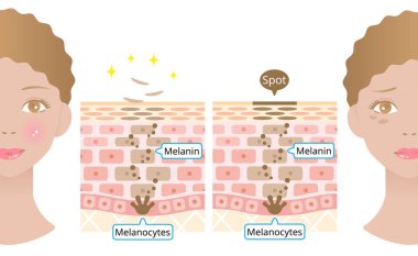 skin cell turnover and black woman face. Melanin and melanocytes in human skin layer with woman face. beauty and skin care concept clipart