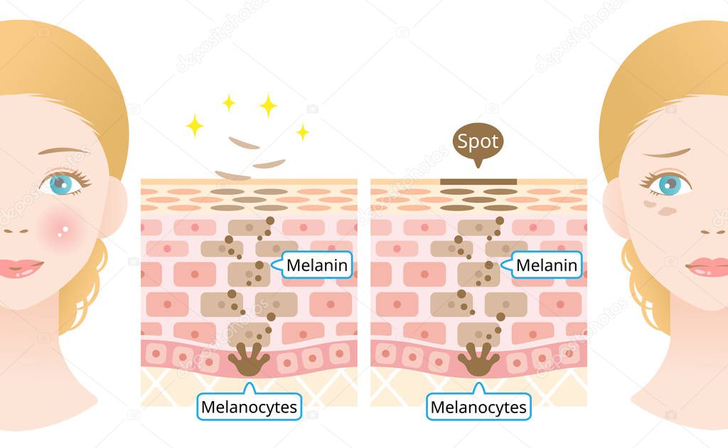 skin cell turnover and caucasian woman face. Melanin and melanocytes in human skin layer with woman face. beauty and skin care concept