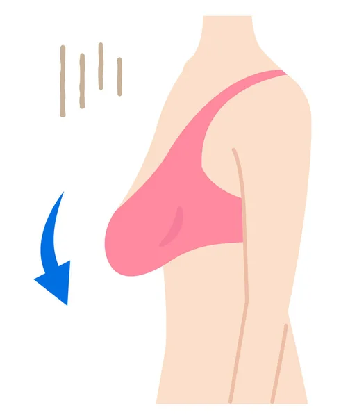 胸と女性の体のイラストをたるませます美体とヘルスケアの概念白い背景に隔離されたおっぱいを垂らす女性 白地に隔離された — ストックベクタ
