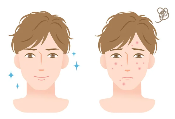 Homme Visage Avant Après Procédure Traitement Acné Concept Soins Peau — Image vectorielle