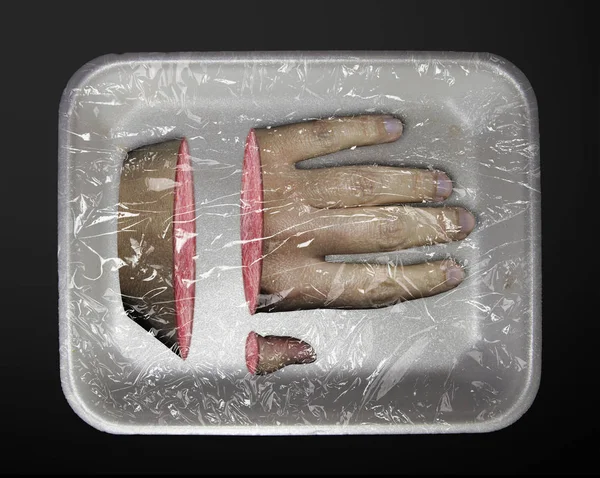 Людська кінцівка в пластиковій тарі — стокове фото
