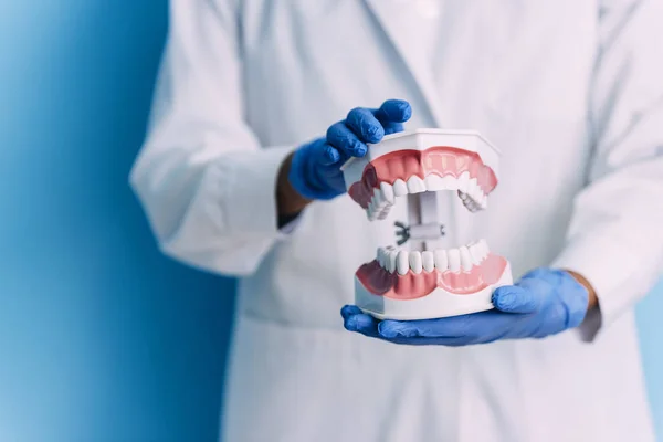 Modelo dentário da mandíbula . — Fotografia de Stock