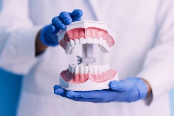 Modelo dentário da mandíbula . — Fotografia de Stock