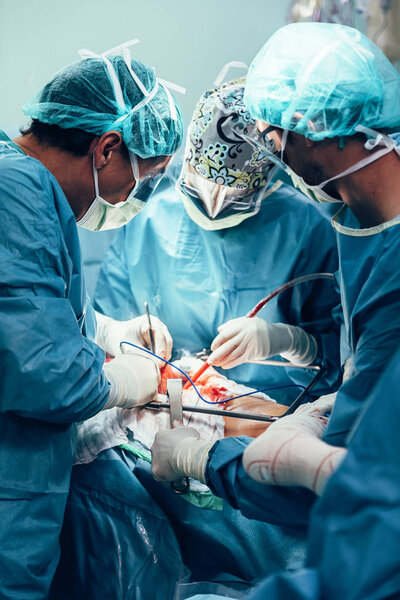 Team of Surgeons Operating.