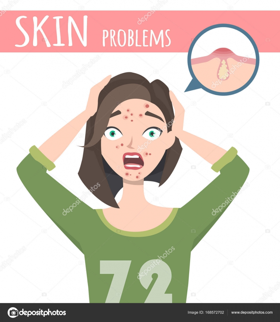 Acne Treatment Before Facial Cleansing Foam Cartoon Illustration U2014 Stock Vector U00a9 Kkn2118