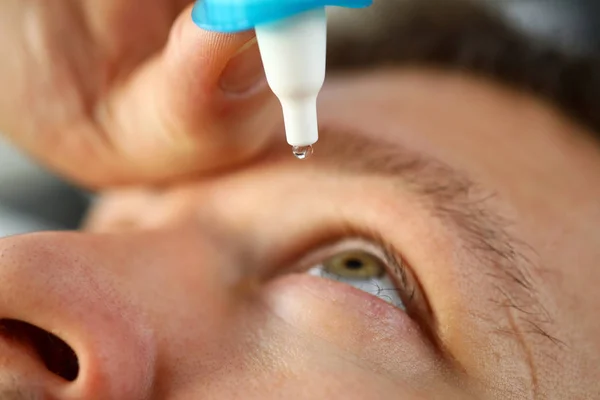 視力の問題を解決する彼の目に液体滴を置く男性の手 — ストック写真