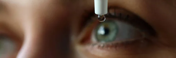 Женщина наливает жидкие капли в глаз, чтобы решить проблему со зрением. — стоковое фото