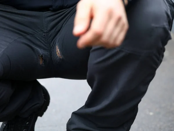 Férfi guggoló helyzetben lyukakkal a nadrágján — Stock Fotó