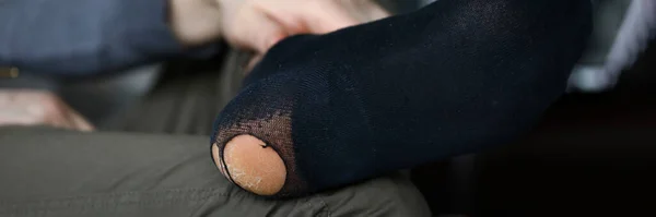 Mann zeigt undichte Socken, Fahrlässigkeit oder Armut — Stockfoto