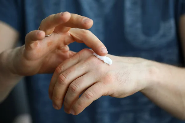 Male hands applying moistening cream on skin — Stock Photo, Image