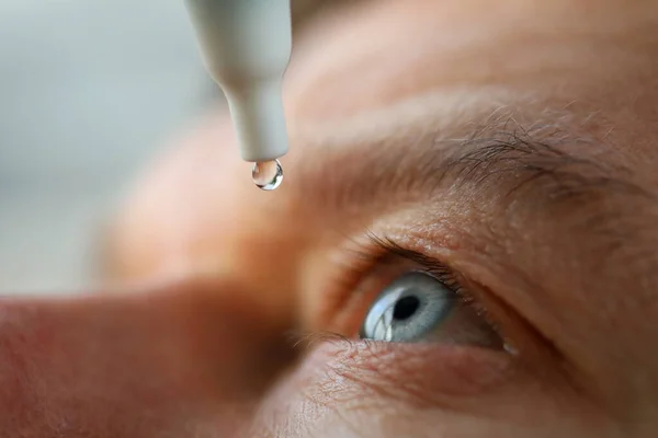 Man droppar ögondroppar installera linser, återfuktande — Stockfoto