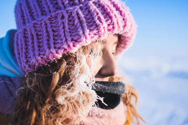 在黄色向红头发美丽背景下营 Barneo 在冰天雪地的北方的白霜的小伙子的头发极冬季夹克粉色针织帽下的女孩 — 图库照片