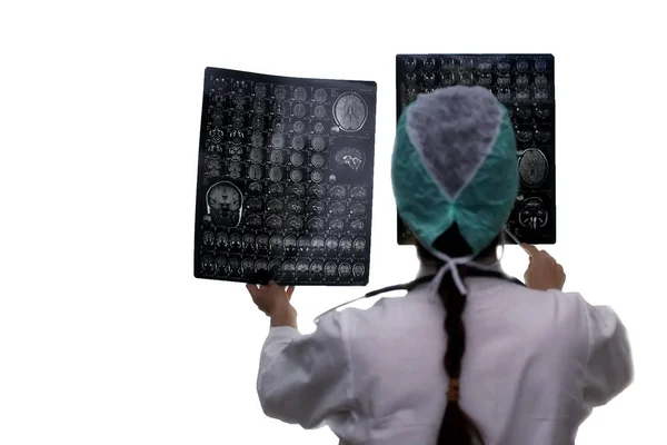 Az orvos egy képet tart az agyáról MRI — Stock Fotó