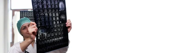 Doctor holding a picture of a brain MRI — Stock Photo, Image