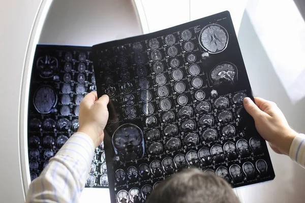 Médico sosteniendo una imagen de un flujo de trabajo de resonancia magnética cerebral — Foto de Stock