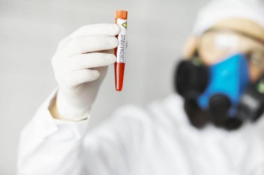 Laboratuvardaki bir bilim adamı viral zatürreenin tedavisi için ilaçları test ediyor. Hastalıklı hastaların Coronovirus kan testi. Dünya salgını.