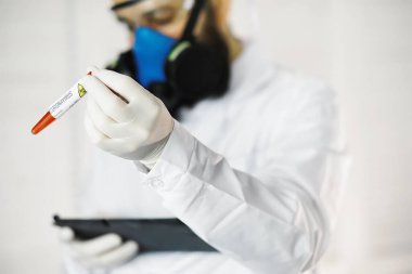 Laboratuvardaki bir bilim adamı viral zatürreenin tedavisi için ilaçları test ediyor. Hastalıklı hastaların Coronovirus kan testi. Dünya salgını.