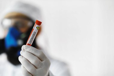 Laboratuvardaki bir bilim adamı viral zatürreenin tedavisi için ilaçları test ediyor. Hastalıklı hastaların Coronovirus kan testi. Dünya salgını.