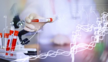 Laboratuvardaki bir bilim adamı viral zatürreenin tedavisi için ilaçları test ediyor. Hastalıklı hastaların Coronovirus kan testi. Dünya salgını.