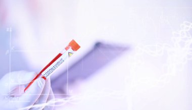 Laboratuvardaki bir bilim adamı viral zatürreenin tedavisi için ilaçları test ediyor. Hastalıklı hastaların Coronovirus kan testi. Dünya salgını.