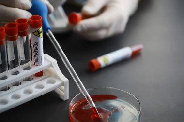 Vücudundaki tehlikeli virüs koronavirüsünü test etmek için bir kan örneği. Coronavirus testi yapılan tüpler. Virüs hastalıklarının laboratuvar çalışmaları.