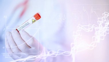 Laboratuvardaki bir bilim adamı viral zatürreenin tedavisi için ilaçları test ediyor. Hastalıklı hastaların Coronovirus kan testi. Dünya salgını.