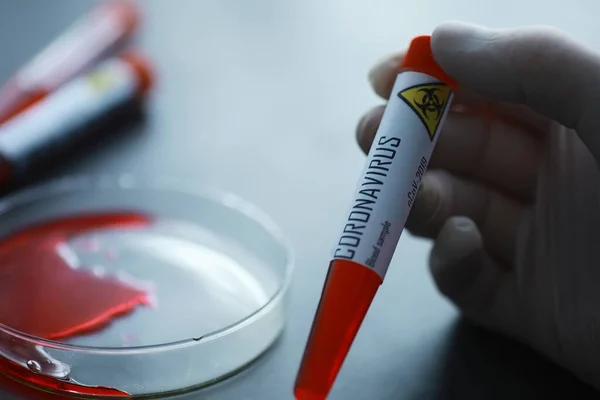 A blood sample for testing the dangerous virus coronavirus in body. Test tubes with tests for coronavirus. Laboratory studies of viral diseases.