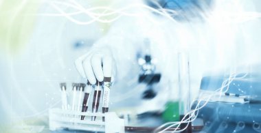 Laboratuvardaki bir bilim adamı viral zatürreenin tedavisi için ilaçları test ediyor. Hastalıklı hastaların Coronovirus kan testi. Dünya salgını.