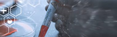 Vücudundaki tehlikeli virüs koronavirüsünü test etmek için bir kan örneği. Coronavirus testi yapılan tüpler. Virüs hastalıklarının laboratuvar çalışmaları.