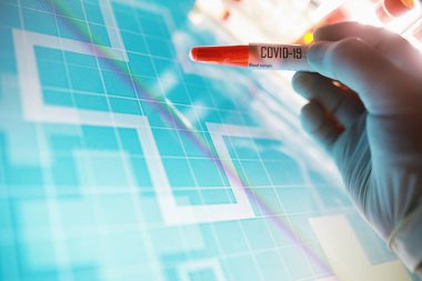 Test tüpü ve hasta kan testi. Virüs analizi. Coronavirus salgını laboratuvar çalışmaları. Aşı geliştirme.