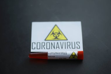 Vücudundaki tehlikeli virüs koronavirüsünü test etmek için bir kan örneği. Coronavirus testi yapılan tüpler. Virüs hastalıklarının laboratuvar çalışmaları.