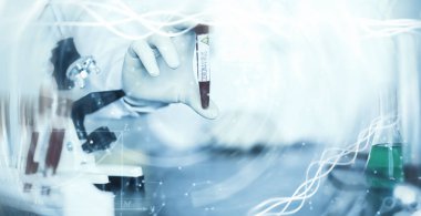 Laboratuvardaki bir bilim adamı viral zatürreenin tedavisi için ilaçları test ediyor. Hastalıklı hastaların Coronovirus kan testi. Dünya salgını.