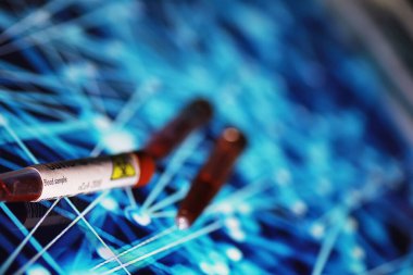 Test tüpü ve hasta kan testi. Virüs analizi. Coronavirus salgını laboratuvar çalışmaları. Aşı geliştirme.