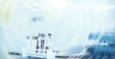 Laboratuvardaki bir bilim adamı viral zatürreenin tedavisi için ilaçları test ediyor. Hastalıklı hastaların Coronovirus kan testi. Dünya salgını.