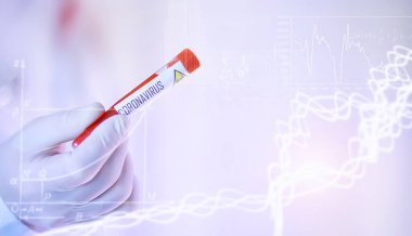 Laboratuvardaki bir bilim adamı viral zatürreenin tedavisi için ilaçları test ediyor. Hastalıklı hastaların Coronovirus kan testi. Dünya salgını.
