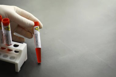 Vücudundaki tehlikeli virüs koronavirüsünü test etmek için bir kan örneği. Coronavirus testi yapılan tüpler. Virüs hastalıklarının laboratuvar çalışmaları.