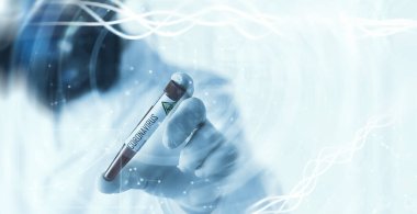Laboratuvardaki bir bilim adamı viral zatürreenin tedavisi için ilaçları test ediyor. Hastalıklı hastaların Coronovirus kan testi. Dünya salgını.