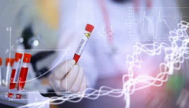 Laboratuvardaki bir bilim adamı viral zatürreenin tedavisi için ilaçları test ediyor. Hastalıklı hastaların Coronovirus kan testi. Dünya salgını.
