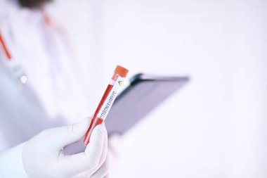 Laboratuvardaki bir bilim adamı viral zatürreenin tedavisi için ilaçları test ediyor. Hastalıklı hastaların Coronovirus kan testi. Dünya salgını.