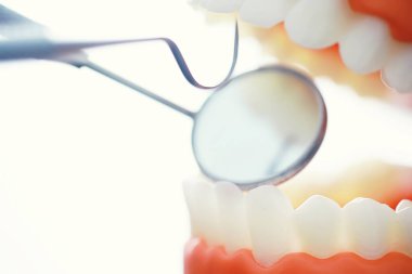 Dişçinin ofisi. Dişçi ağız boşluğu tedavisini inceliyor. Doktor bir tedavi yöntemi gösteriyor. Tedavi görüyor. Kaplamaların yerleştirilmesi ve yerleştirilmesi.