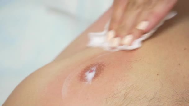 Cuidado de la piel después de la acumulación de un pezón de hombre — Vídeos de Stock